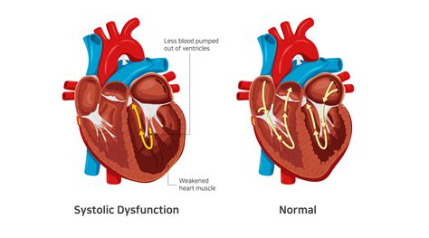 depressed lv function|Systolic Heart Failure: Symptoms, Causes and Treatment.